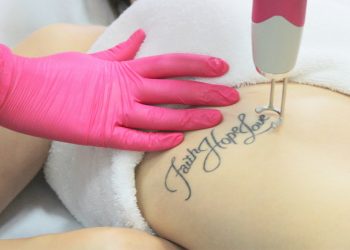 Błędy młodości – jak pozbyć się niechcianego tatuażu?