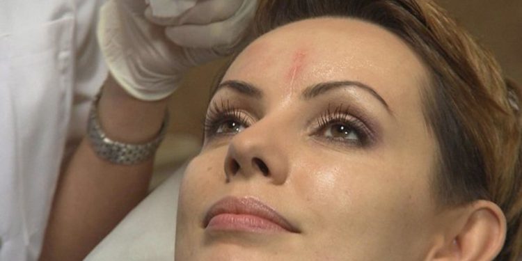 Wstydliwe kompleksy gwiazd