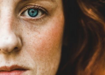 Przebarwienia i zaczerwienienia na twarzy – czy to już objawy alergii?