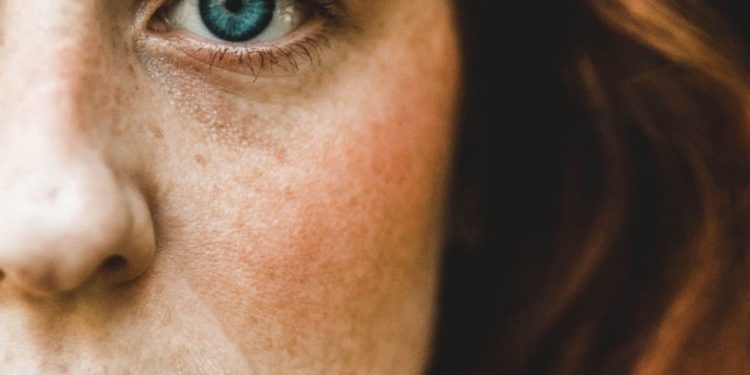 Przebarwienia i zaczerwienienia na twarzy – czy to już objawy alergii?