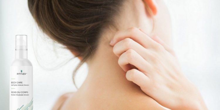 co to jest luzpiez pstry