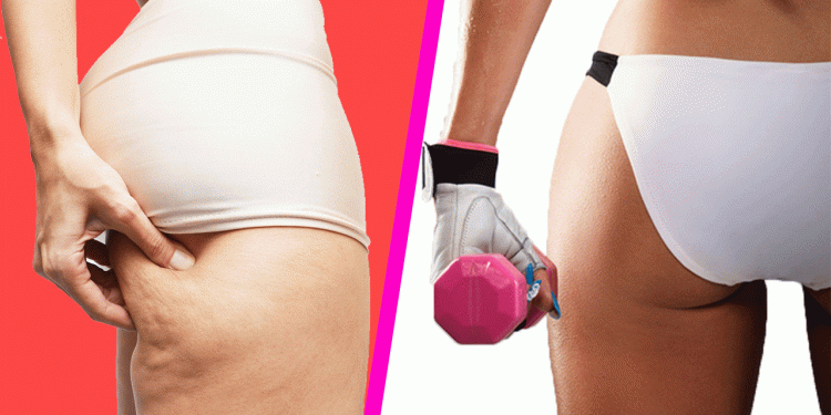 jakie cwiczenia na cellulit